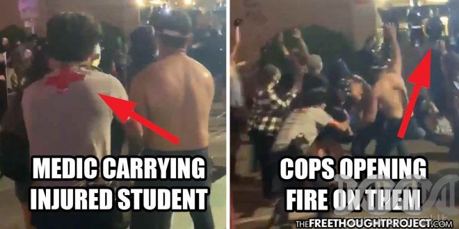 WATCH: Cops Shoot Innocent Student in Head with Rubber Bullet, Open Fi