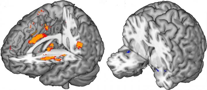 Part of the human brain contributing the most to the prediction of pai