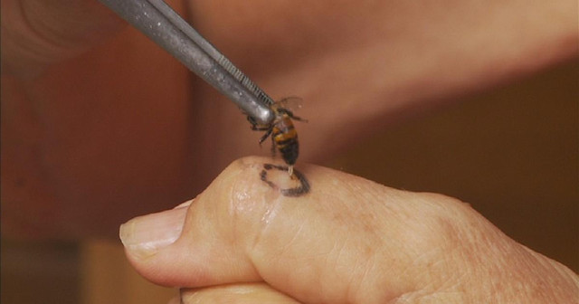 Gydymas bičių nuodai liaudies medicinoje