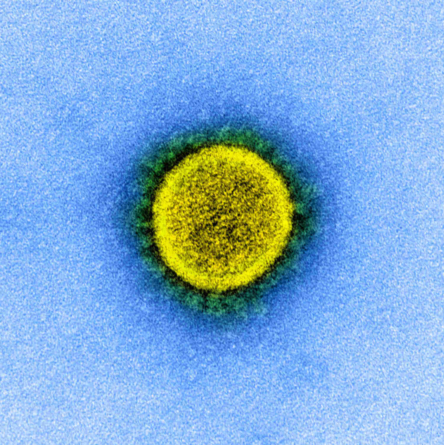 Coronavirus survives on skin five times longer than flu: study