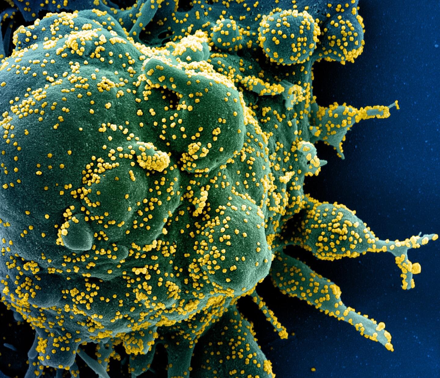 Coronavirus: Study finds further door opener into the cell