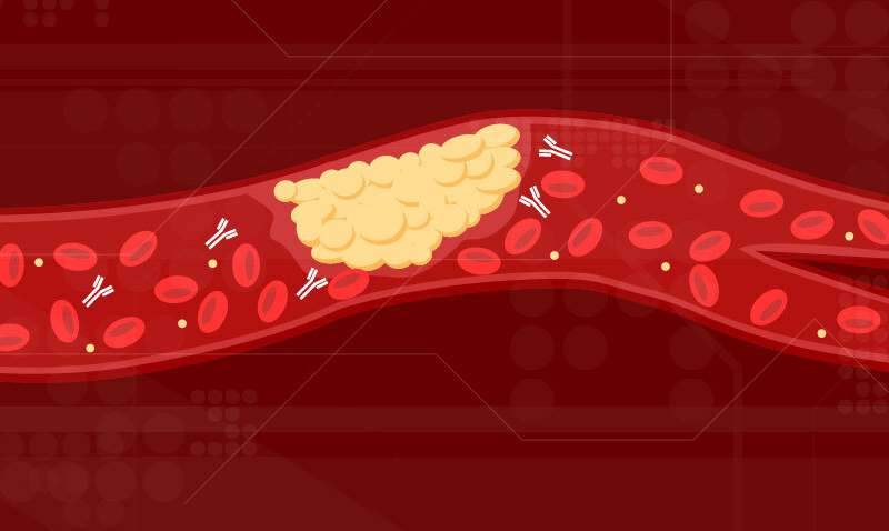 New cause of COVID-19 blood clots identified
