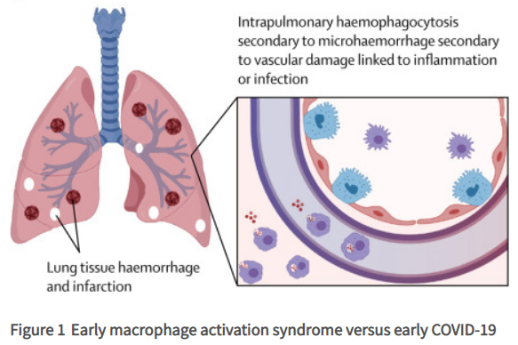 Cardiologist warns about covid vaccine fraud and hyper-inflammatory im