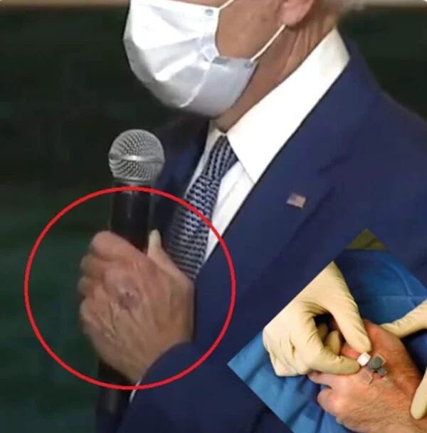 Atrodo, kad nuotraukos rodo ant Bideno rankos žaizdos