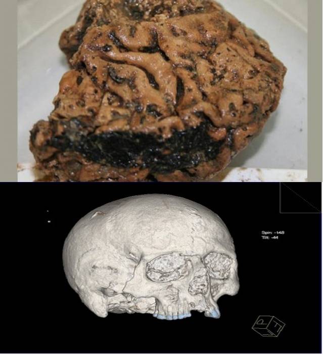 Rastos smegenys akmens amžiaus apie 2500 metus