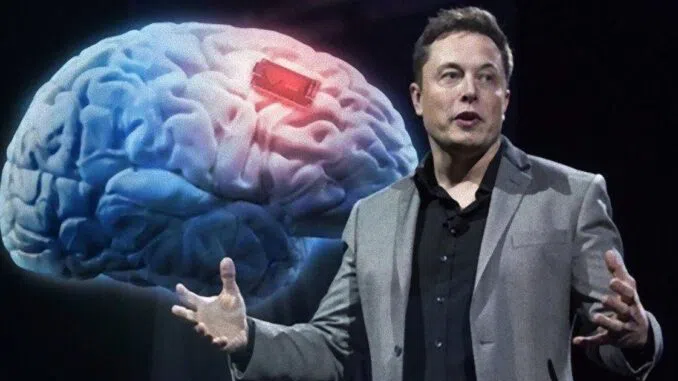 Elono Musko smegenų lustų bendrovė "Neuralink" žengia žingsnį arčiau