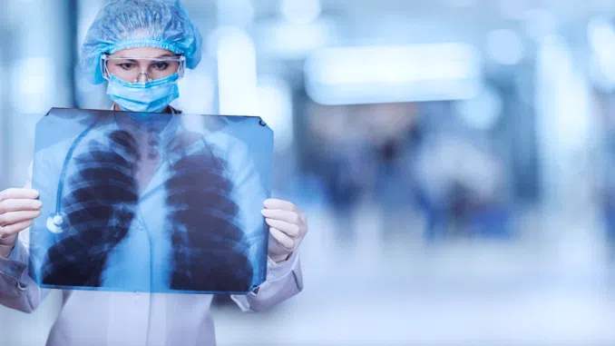 žmonių plaučiai dabar yra užteršti vienkartinėse kaukėse aptiktu mikro