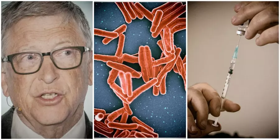Gatesas skiria 400 mln. dolerių naujai tuberkuliozės vakcinai