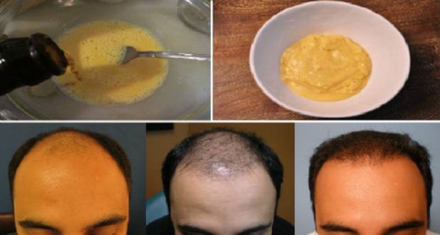 Metodas kuris skatina plaukų augimą