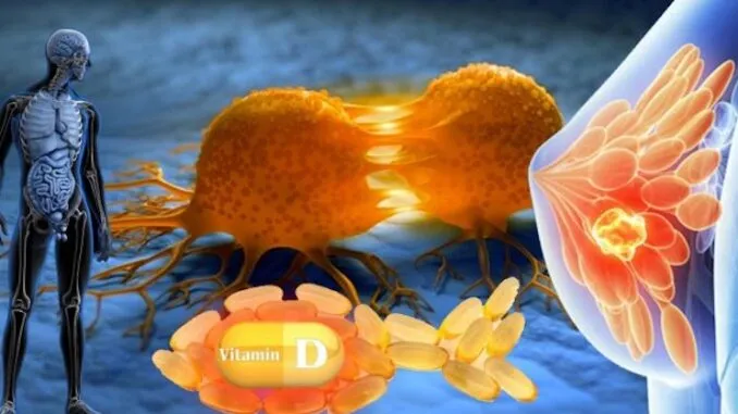 Oficialiu tyrimu patvirtinta, kad vitaminas D padeda kovoti su visomis vėžio formomis