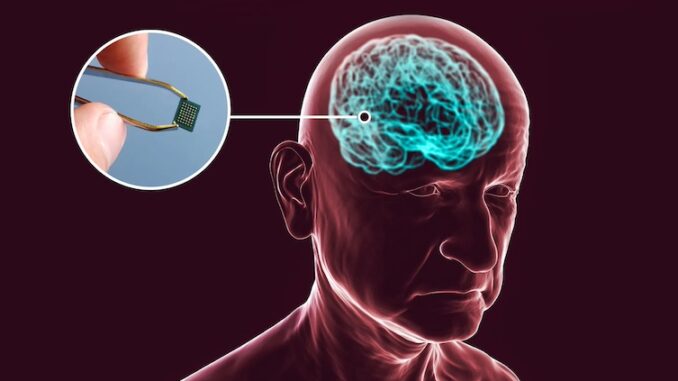 Didžiosios technologijų bendrovės planuoja naudoti smegenų lustus, kad galėtų skaityti vartotojų mintis: tyrimas