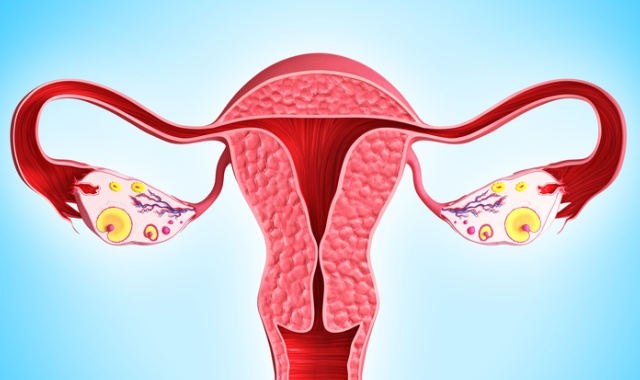 Endometriozė