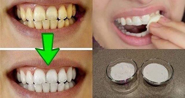 Garantuota! Nubalinkite savo geltonus dantis per 2 minutes!