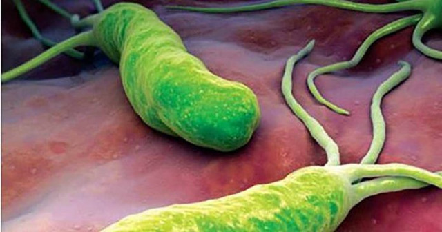 Natūralus būdas pašalinti Helicobacter pylori bakterija iš skrandžio!
