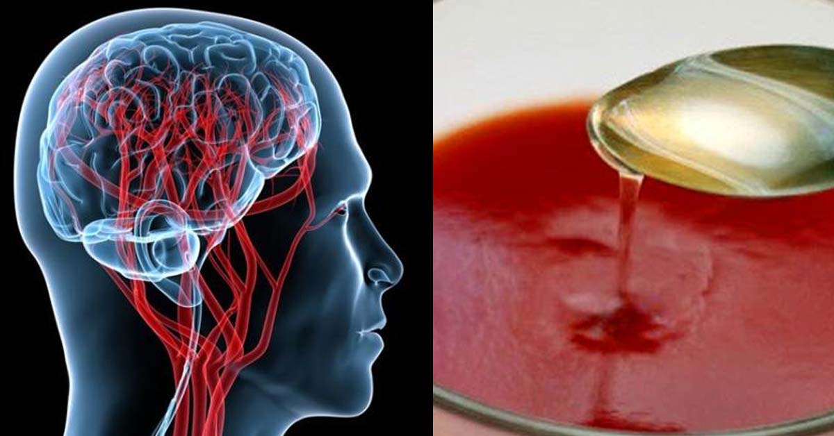 15 produktų, kurie padės sumažinti kraujo spaudimą