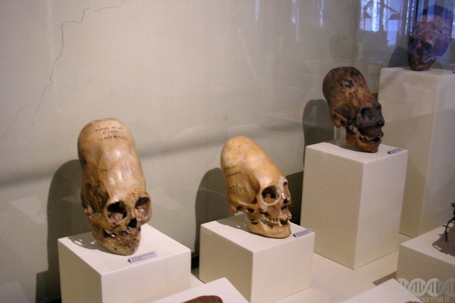 Pailgos žmonių kaukolės, aptinkamos Peru ir kitose pasaulio vietose