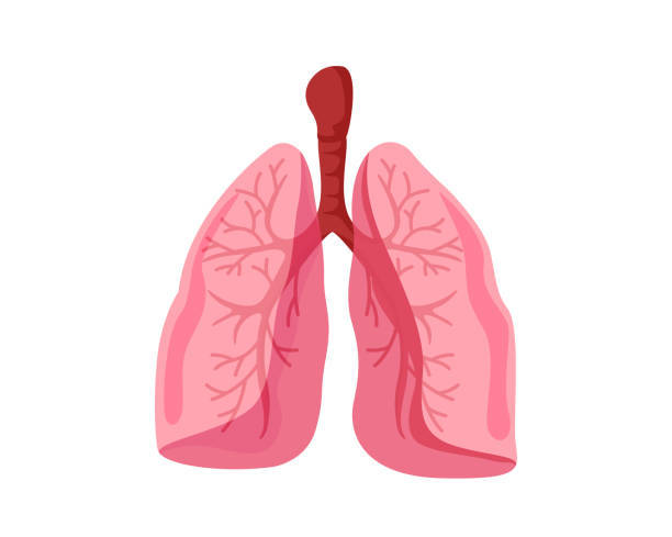 sveikata, bronchitas, plaučių uždegimas, skrepliai, uždegimas, kosulys