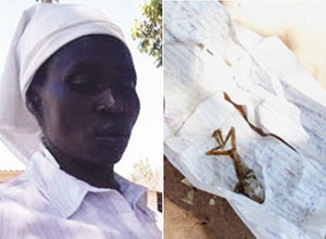 Moteris Zimbabvėje pagimdė varlę